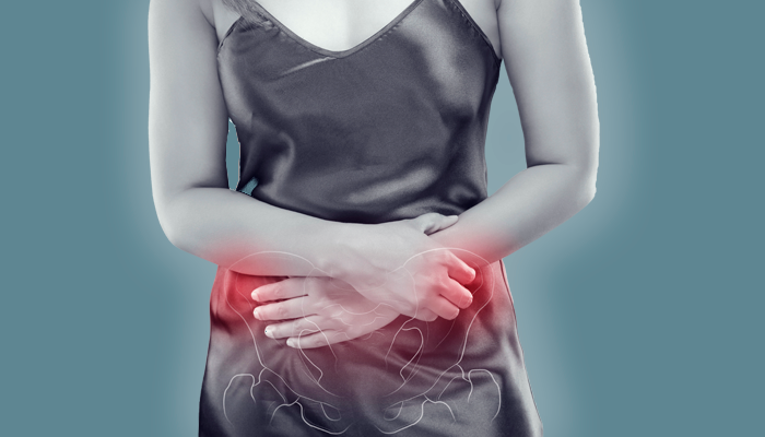 La enfermedad inflamatoria pélvica o EIP